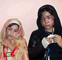 Dos de las hermanas agredidas. | Reuters