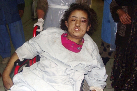 Sahar Gul, en el momento de ser trasladada a un hospital afgano. | Ap