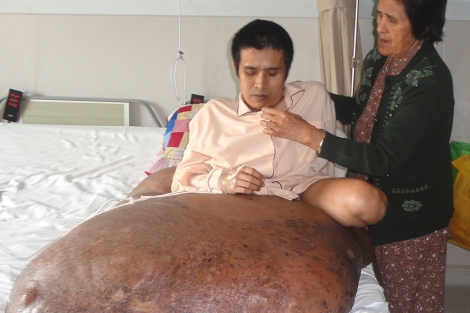 El joven Duy Hai junto a su madre antes de ser operado. | Afp