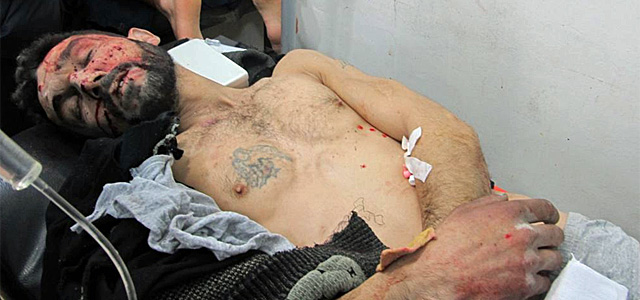 Un herido en un hospital improvisado en Bab Amro.| Reuters