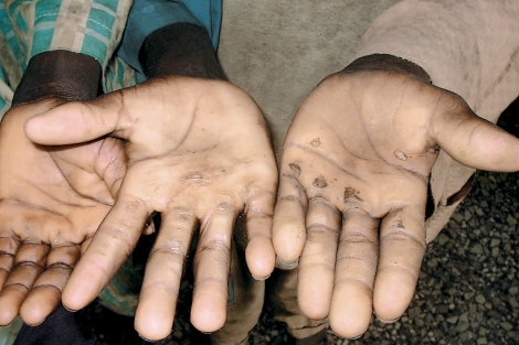 Imagen de archivo de las manos de nios esclavos en Benn. | El Mundo
