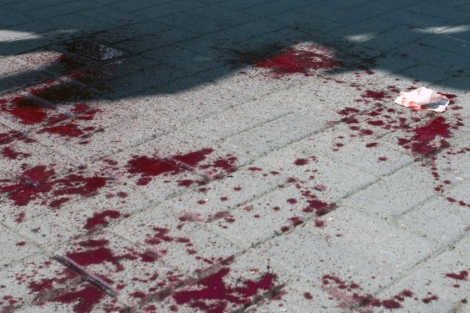 Sangre en una calle de la ciudad de Dnipropetrovsk, en el este de Ucrania. | Afp