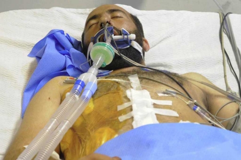 Un hombre herido en el atentado en un hospital de Kandahar. | Afp