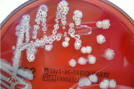 Colonias de la bacteria Pseudomonas stutzeri, cepa ZoBell, cultivada en una placa de Petri.| UIB
