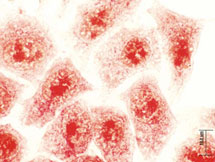 Clulas cancergenas incubadas con nanopartculas de peroskita. | A. H.