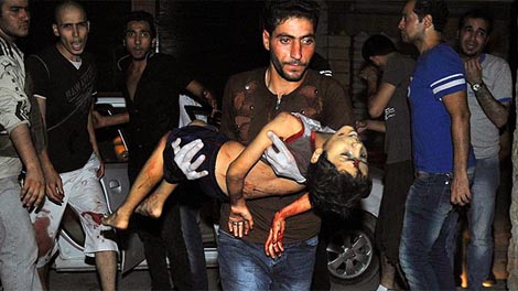 Un hombre traslada a un niño herido enlos combates.