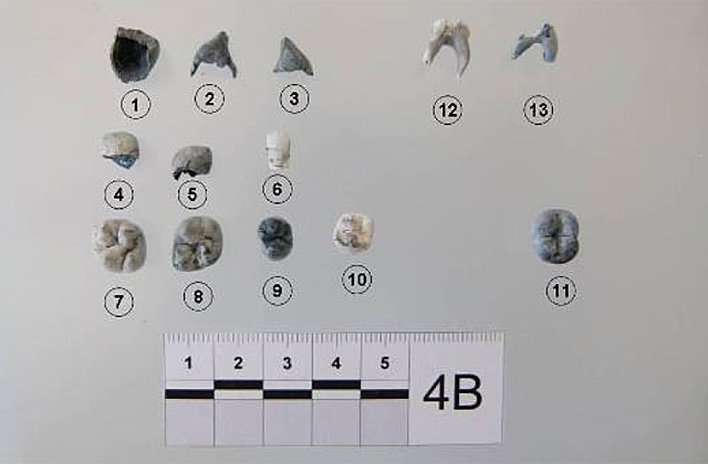 Conjunto de dientes infantiles y fragmentos recogidos en Las Quemadillas y analizados por el forense.