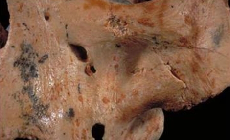 Crneo de 'Homo Antecessor' con marcas de corte y mordeduras. | IPHES