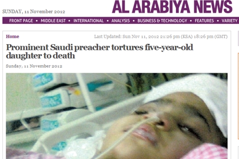 Imagen de la pequea en el hospital. | 'Foto: Al Arabiya'