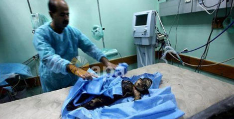 El beb palestino de 11 meses fallecido en Gaza.