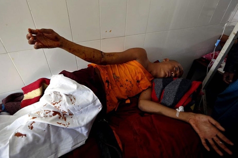 Un monje budista herido en la carga de la polica birmana. | Efe
