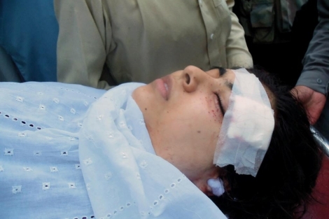 La joven activista Malala Yousafzai, en el hospital. | Afp