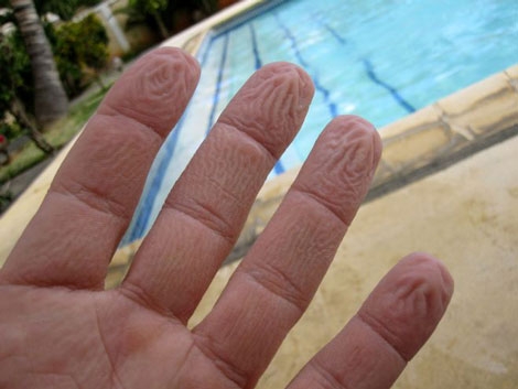 Una mano arrugada tras un baño en una piscina. | E. M.