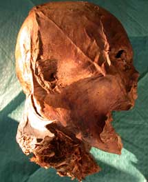 Cabeza momificada de Enrique IV. | CSIC