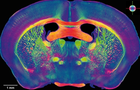 Radiografía de un cerebro humano. | Human Brain Project