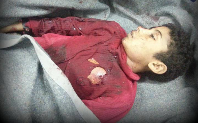 El cuerpo de Omar Salah en una morgue local el pasado da 3.