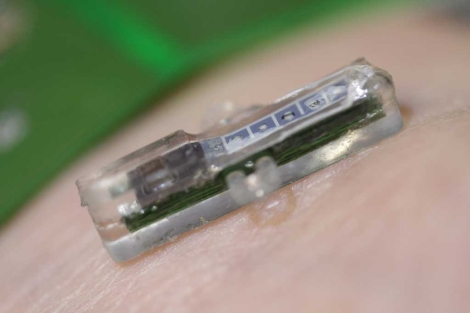 El implante mide dos centmetros. | EPFL