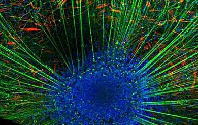 Neuronas obtenidas a partir de clulas madre de cordn. | CMRB