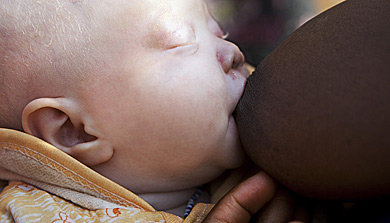 Una mujer amamanta a su beb albino en Kabanga . | Ana Palacios