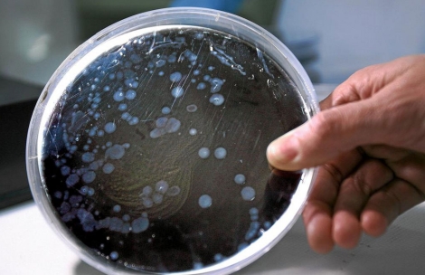 Cultivos de la bacteria de la legionela en un laboratorio. | Ernesto Caparrs