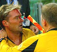 Anders Frisk, tras ser agredido durante el partido Roma-Dinamo Kiev. (Foto: REUTERS)