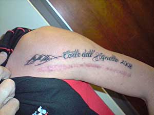 Pereiro muestra el tatuaje que se ha hecho sobre la cicatriz: 'Colle Dell'Agnello 2008'.