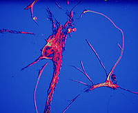 Una neurona. | PhotoDisc