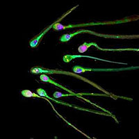 Varios espermatozoides marcados con un tinte verde. (Foto: Science | EPA)