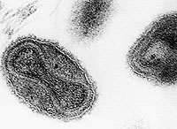 Vista microscpica del virus de la viruela en una foto del Centro de Control de Enfermedades de EEUU. (Foto: AP)