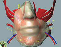 En esta imagen del Hospital de Lyon (Francia) puede verse el modelo tridimensional de la reconstruccin de la nariz, los labios y la barbilla del primer trasplante parcial de cara en el mundo (Foto: AP)