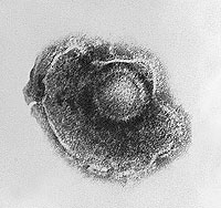 El virus varicela zster (Foto: CDC)