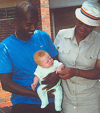 Una pareja muestra a su primer hijo, que padece albinismo, en Johanesburgo. (Foto: AP | March of Dimes)