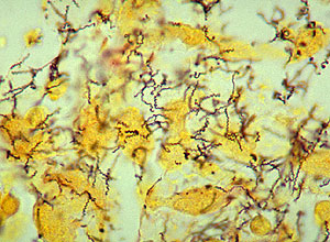 Imagen del 'Treponema pallidum', responsable de la sfilis. (Foto: CDC)