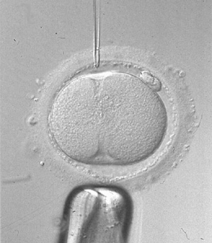 Un espermatozoide es inyectado en un óvulo.