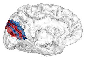 Vista del surco parietooccipital de los sujetos que aprendían rápido (rojo) y los lentos (azul). (Imagen: extraída del estudio)