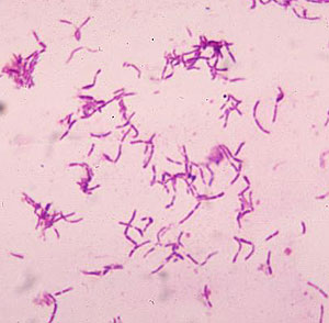 Imagen de bacterias lácticas. (Foto: CDC)