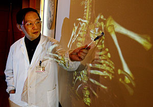 Uno de los cirujanos muestra una radiografa del paciente (Foto: Mark Ralston | AFP)