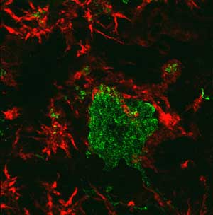En rojo, clulas de microglia rodeando a las neuronas motoras (en verde) procedentes de la mdula espinal de ratones con la mutacin en el gen SOD1, que provoca la esclerosis lateral amiotrfica. (Foto: Boille)