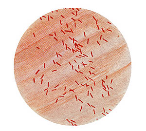 Imagen de laboratorio de la 'E.coli'. (Foto: CDC)