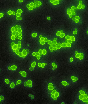 'Candida albicans' con tincin flourescente (Foto: CDC)