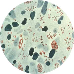Fotomicrograma del bacilo 'Mycobacterium leprae' (Foto: CDC)
