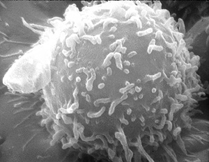 Imagen de un linfocito al microscopio (Foto: NCI)