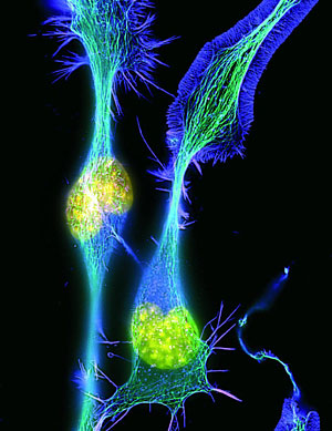 Neurona. (Foto: Cosmocaixa)