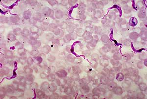 Clulas sanguneas de rata infectadas por 'Trypanosoma brucei'. (Foto: CDC)