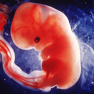 Imagen de un feto. (Lennert Nilsson | AP)