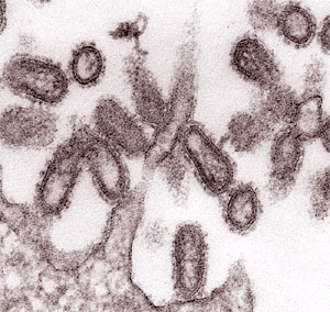 Rasgos morfolgicos del virus de la gripe de 1918 (Foto: CDC)