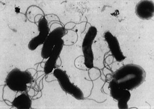 Imagen microscpica de 'Helicobacter pylori'. (Foto: El Mundo)
