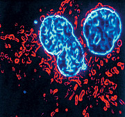 Imagen del estudio que muestra la accin del DCA sobre una clula maligna