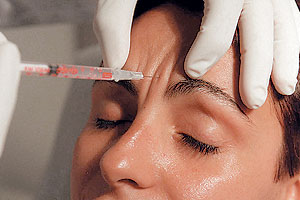 Una mujer recibe una inyección de Bótox (Foto: El Mundo)