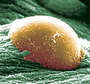 Imagen de la bacteria E. coli (Scott J. Hultgren y John Heuser)